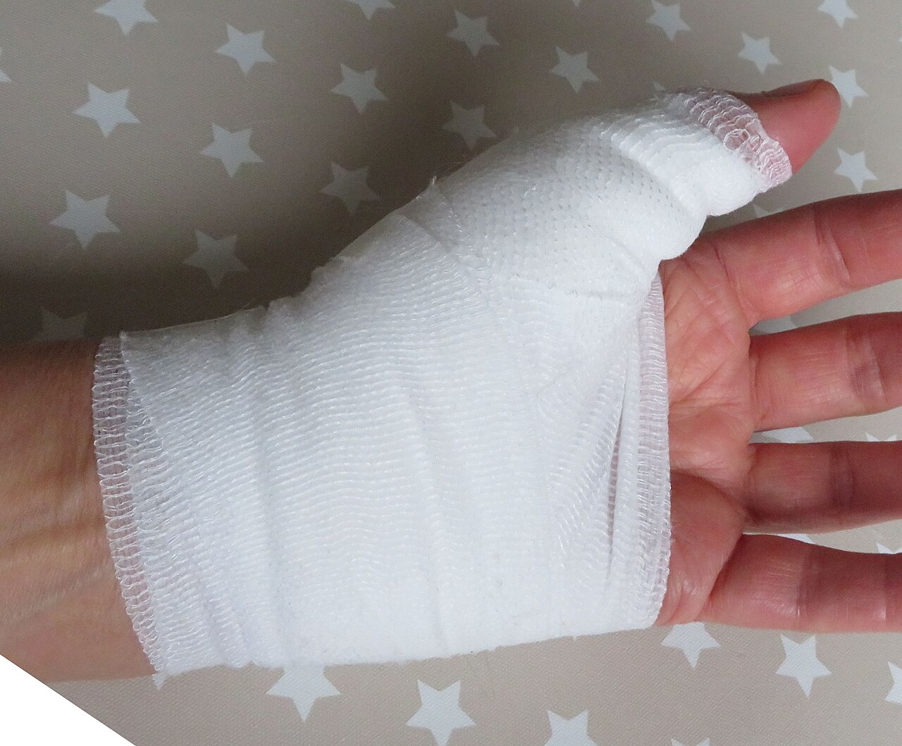 Первая помощь при укусе или царапине от питомца